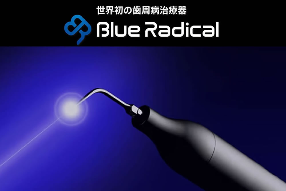 ブルーラジカルによる非外科的歯周病治療